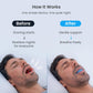 Anti Snore Mouthpiece - FDA-Registered Snoring Aid - Food-Grade Silicone - Boil & Bite Custom Fit Snoring Relief - Reusable with Storage Case - Helps Reduce Snoring for Quieter Nights (Blue)