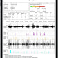 EMAY Sleep Breathing Monitor for Airflow Tracking | Record Breathing Continuously On the App | Monitor Sleep Quality and Respiratory Events | Generate Professional Sleep Report with Data Analysis