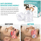 Anti Snoring Device - Tongue Retaining Mouthpiece