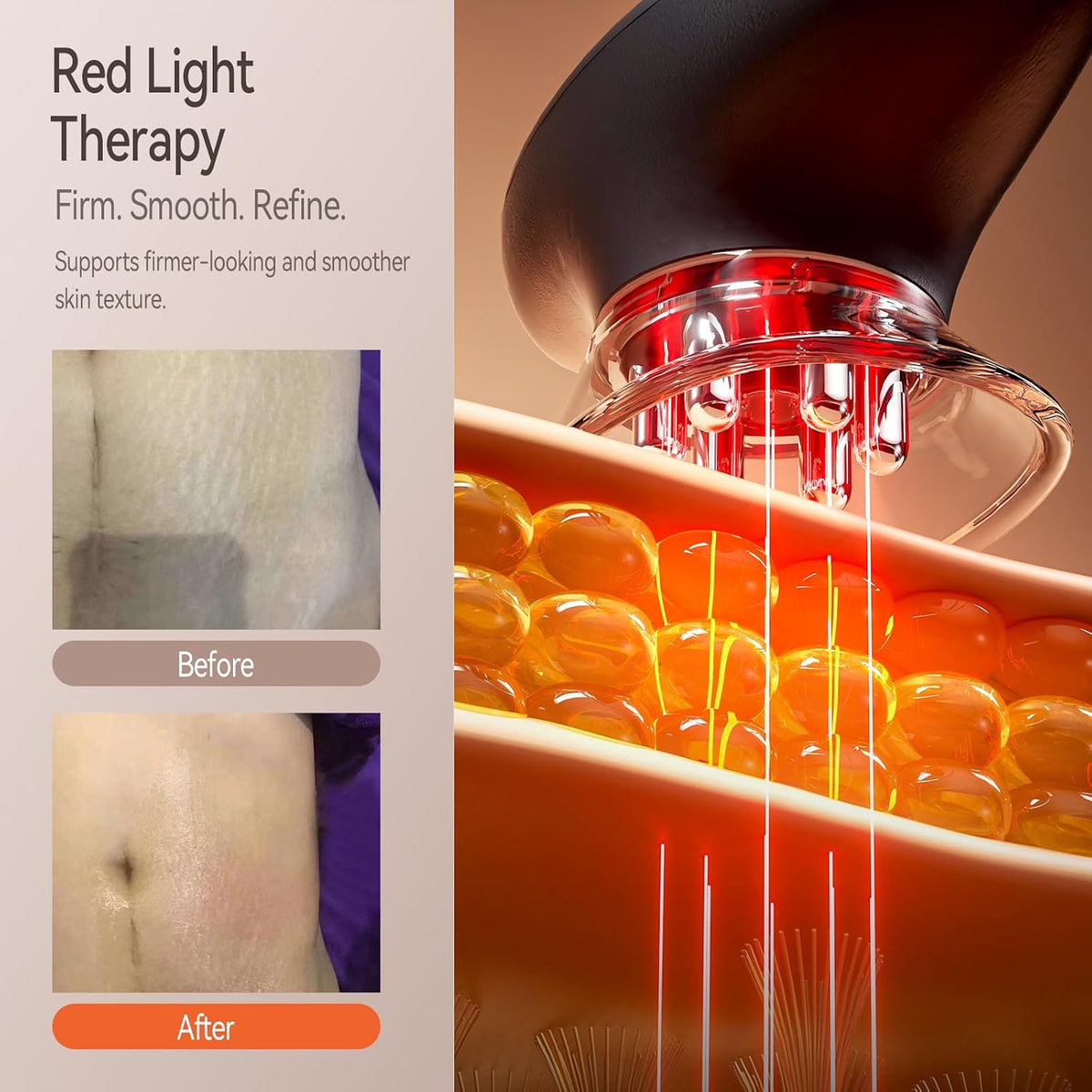 3-in-1 Body Sculpting Machine with Red Light, Vacuum & Microcurrent