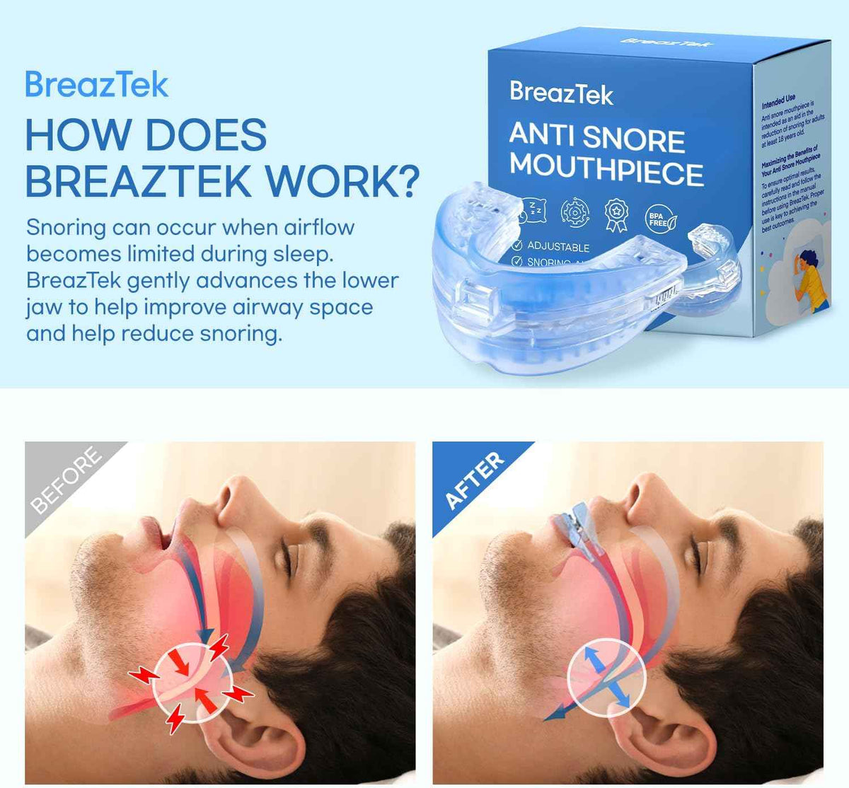 Anti Snore Mouthpiece: FDA Cleared Snoring Device