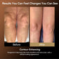 INIA FASCIOR Body Sculpting & Recovery Device with Core/Legs/Arms Modes