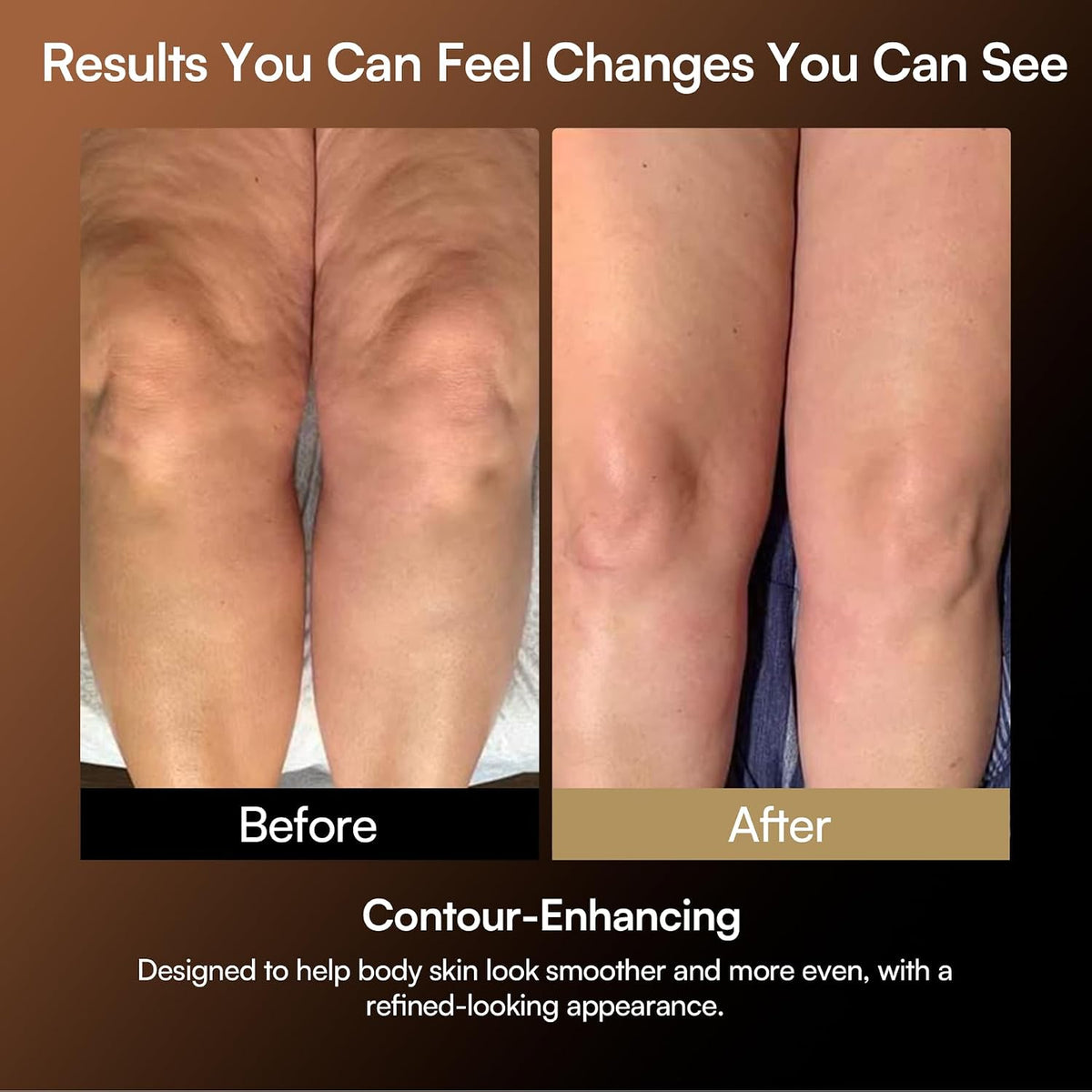 INIA FASCIOR Body Sculpting & Recovery Device with Core/Legs/Arms Modes